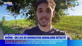 Rhône : un cas de dermatose nodulaire détecté