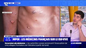 Mpox : les médecins français sur le qui-vive - 17/08