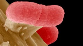 Image de bactéries Escherichia coli (E. coli) producteurs de shiga-toxines (STEC) observées au microscope électronique. L'état de santé des trois Français qui auraient été affectés par une forme virulente d'infection à la bactérie E.coli imputée à des con