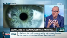#CDEJADEMAIN : Des maladies oculaires diagnostiquées par Google