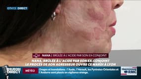 Témoin RMC : Nana - 22/10