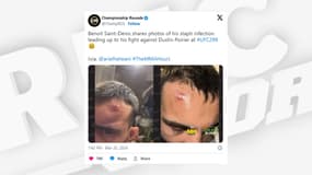 Les images du staphylocoque de Benoît Saint Denis avant son combat face à Dustin Poirier
