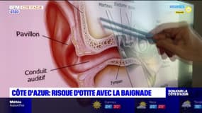 Côte d'Azur: attention aux risques d'otite avec la baignade