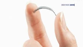 Un implant Essure fabriqué par Bayer