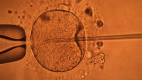 Photo prise au Centre d'étude et de conservation du sperme humain à Rennes d'un écran de contrôle représentant la micro-injection par pipette d'un spermatozoïde dans un ovocyte