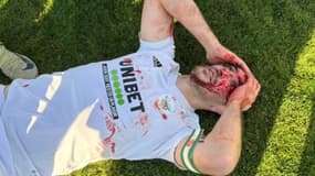 Un joueur de foot du RC Chambéry a été blessé au visage par un coup de clef en marge d'une rencontre