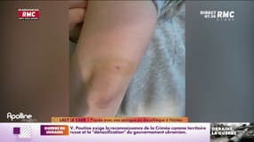 Nantes: trois plaintes déposées après des agressions à la seringue en boîte de nuit 