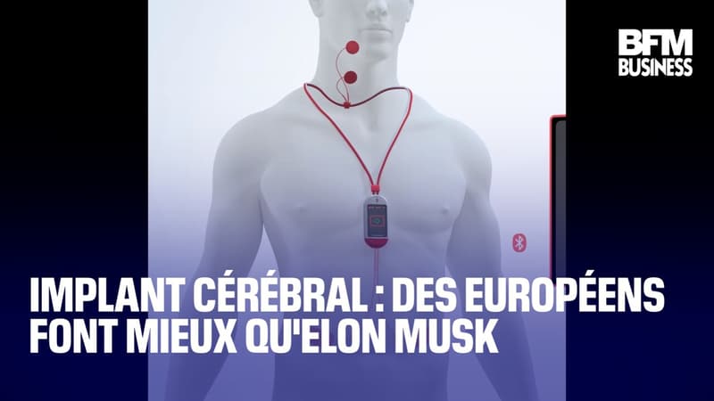 Implant cérébral : des Européens font mieux qu&#039;Elon Musk