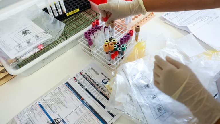Des tests de dépistage du chikungunya sont faits au laboratoire du centre hospitalier universitaire de Saint-Denis, sur l'île de La Réunion, le 10 avril 2025