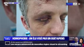 Luc Di Gallo, adjoint au maire de Montreuil, victime d'un guet-apens homophobe