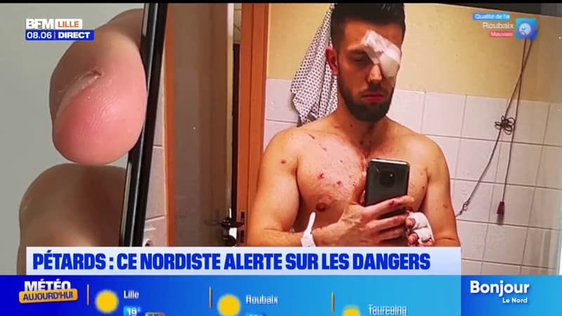Kévin, devenu malvoyant après l’explosion d’un pétard, témoigne pour faire de la prévention