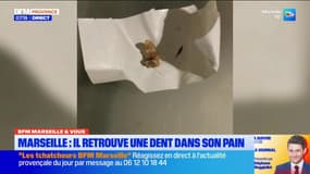 BFM Marseille et vous: un homme retrouve une dent dans son pain