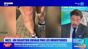 BFM Nice et vous : un quartier de Nice envahi par les moustiques, Pascal alerte sur la situation