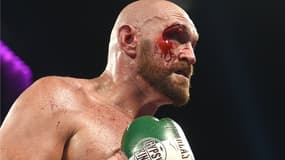 La grosse coupure de Tyson Fury à l'oeil droit