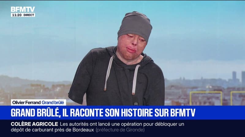 "Un après est totalement possible": Olivier Ferrand, grand brûlé, raconte son parcours de reconstruction et apporte son soutien aux victimes de l'incendie de Crans-Montana