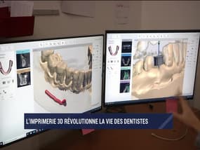 La France qui bouge: L'imprimerie 3D révolutionne la vie des dentistes - 25/11