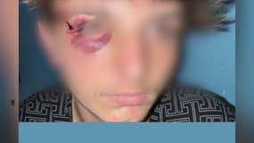 Paul, âgé de 17 ans et victime d'une agression homophobe à Mazamet (Tarn) le 21 septembre 2024.