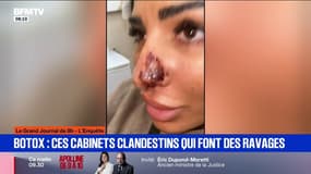 "Le pus coulait": les injections illégales de botox font des ravages