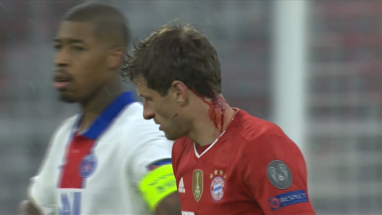 Thomas Müller la tête en sang Thomas Müller la tête en sang