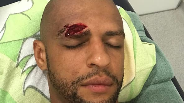 Felipe Melo