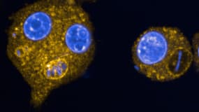 Une image prise au microscope en 2024 et publiée par l'Institut Pasteur le 27 mai 2025 montre des macrophages infectés par la bactérie Yersinia pestis.