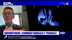 Endométriose: Endolille, un centre de soins dédié dans la capitale des Flandres