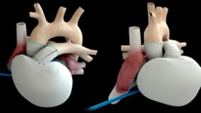 Le coeur artificiel de Carmat va être implanté pour la première mondiale sur des patients en France.