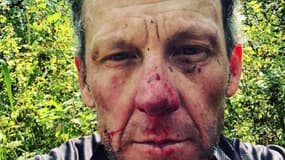 Lance Armstrong