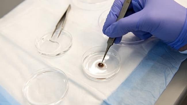 Le patch cellulaire imprimé en 3D comparé à un coeur de souris.