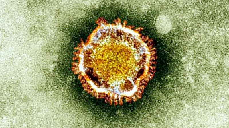 Le coronavirus Covid-19 vu au microscope - Image d'illustration