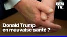  Pourquoi l’apparition de Donald Trump ne suffit pas à calmer les rumeurs sur son état de santé 