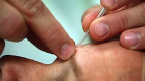 L'acupuncture fait partie des soins complémentaires au traitement du cancer.