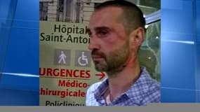 Homophobie: le mari du président de Paris Foot Gay raconte son agression