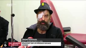A la Une des GG : Blessure de Jérôme Rodriguez, les versions s'opposent, qui a raison ? - 28/01