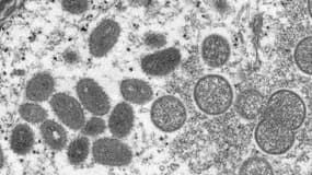 Image issue d'un microscope électronique montrant un virion de variole du singe, obtenu d'un échantillon issu de l'épidémie chez des chiens de prairie en 2003.
