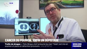 Cet hôpital sera l'un des premiers à participer à un projet de dépistage organisé du cancer du poumon