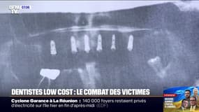 Victimes de dentistes low-cost: des patients se mobilisent pour obtenir justice