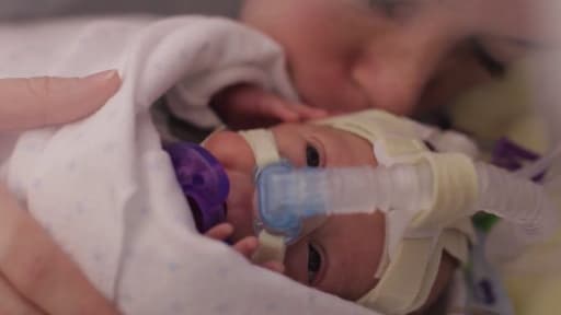 Un jeune papa a filmé la première année de son bébé, grand prématuré.