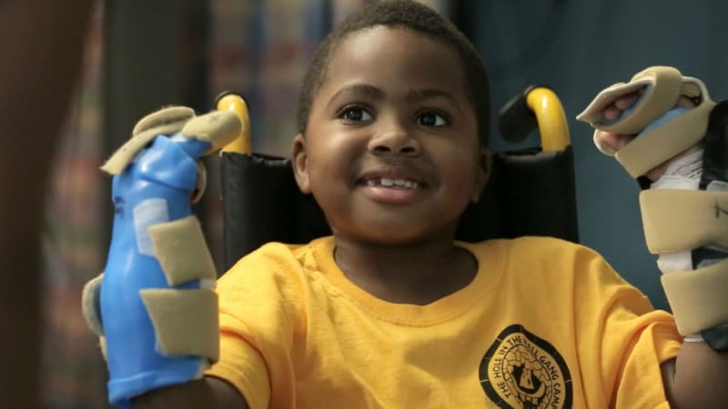 Zion Harvey, greffé des deux mains, à l'hôpital des enfants de Philadelphie, le 29 juillet 2015.