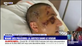 "Si rien n'est fait, ce sera un autre policier ou un citoyen à ma place ": le policier agressé à Rive-de-Gier témoigne