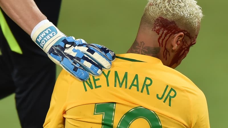 Neymar le visage en sang