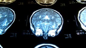 IRM d'un cerveau humain. (Illustration)