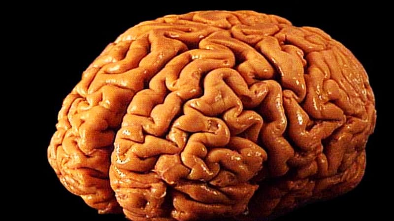Un cerveau humain masculin est identique à un cerveau humain féminin