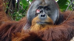 Cette photo diffusée par la Fondation SUAQ le 23 juin 2022 montre Rakus, un orang-outan mâle avec une blessure au visage, dans le parc national de Gunung Leuser, au nord de Sumatra, en Indonésie. 