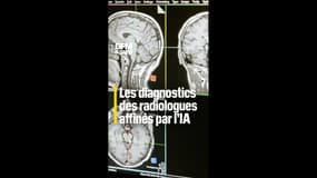 Comment l'IA aide les médecins à lire les radios