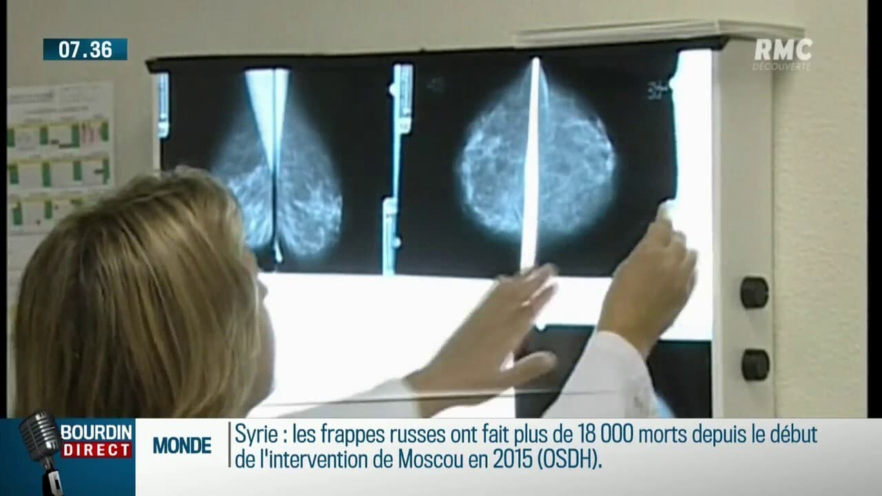Le dépistage, la solution pour guérir d'un cancer du sein