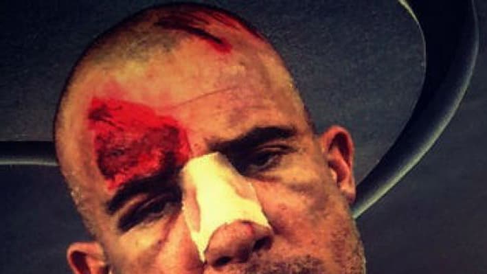 Dominic Purcell s'est blessé sur le tournage de la saison 5 de "Prison Break"