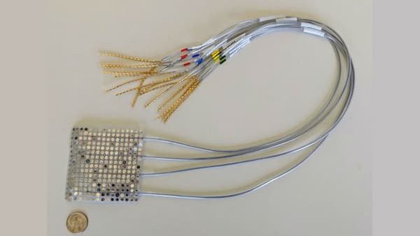 Le réseau d'électrodes placé sur le cerveau Le réseau d'électrodes placé sur le cerveau