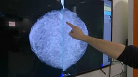 L'intelligence artificielle pourrait faciliter le dépistage du cancer du sein