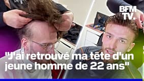 "Ça vaut le prix": Contre la calvitie, Jules a décidé d'opter pour des suppléments de cheveux